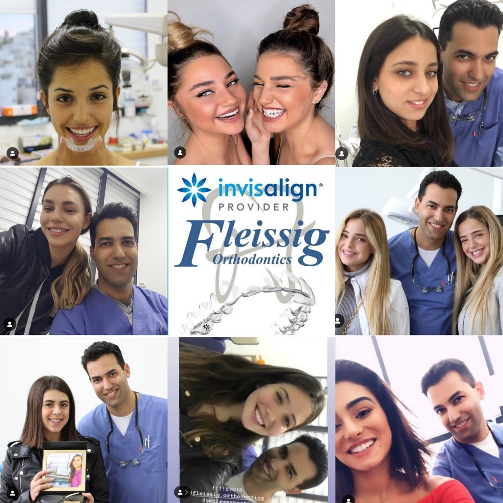 אקססוריז לאינויזליין Invisalign!
